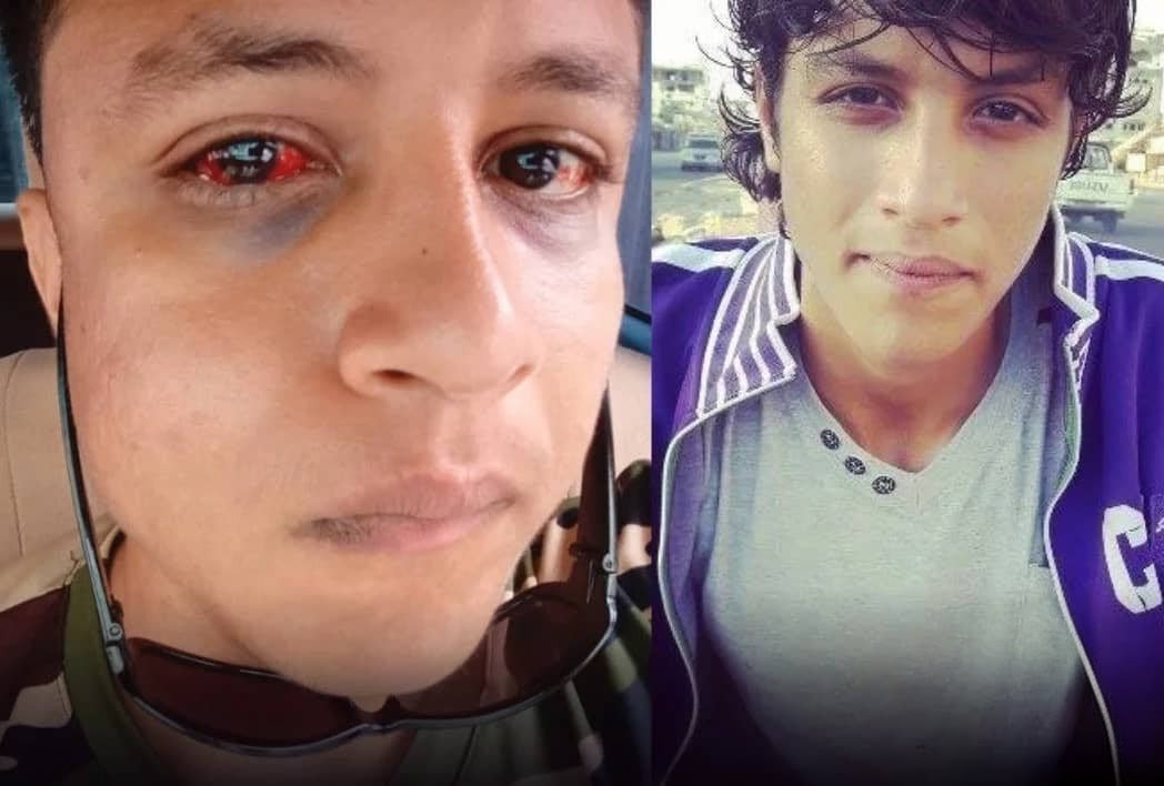 شاب يشكو تعرضه لاعتداء جسدي من ضابط في شرطة البريقة بعدن