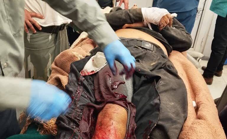 استشهاد مواطن برصاص قناصة ميليشيا حوثي شرق مدينة تعز