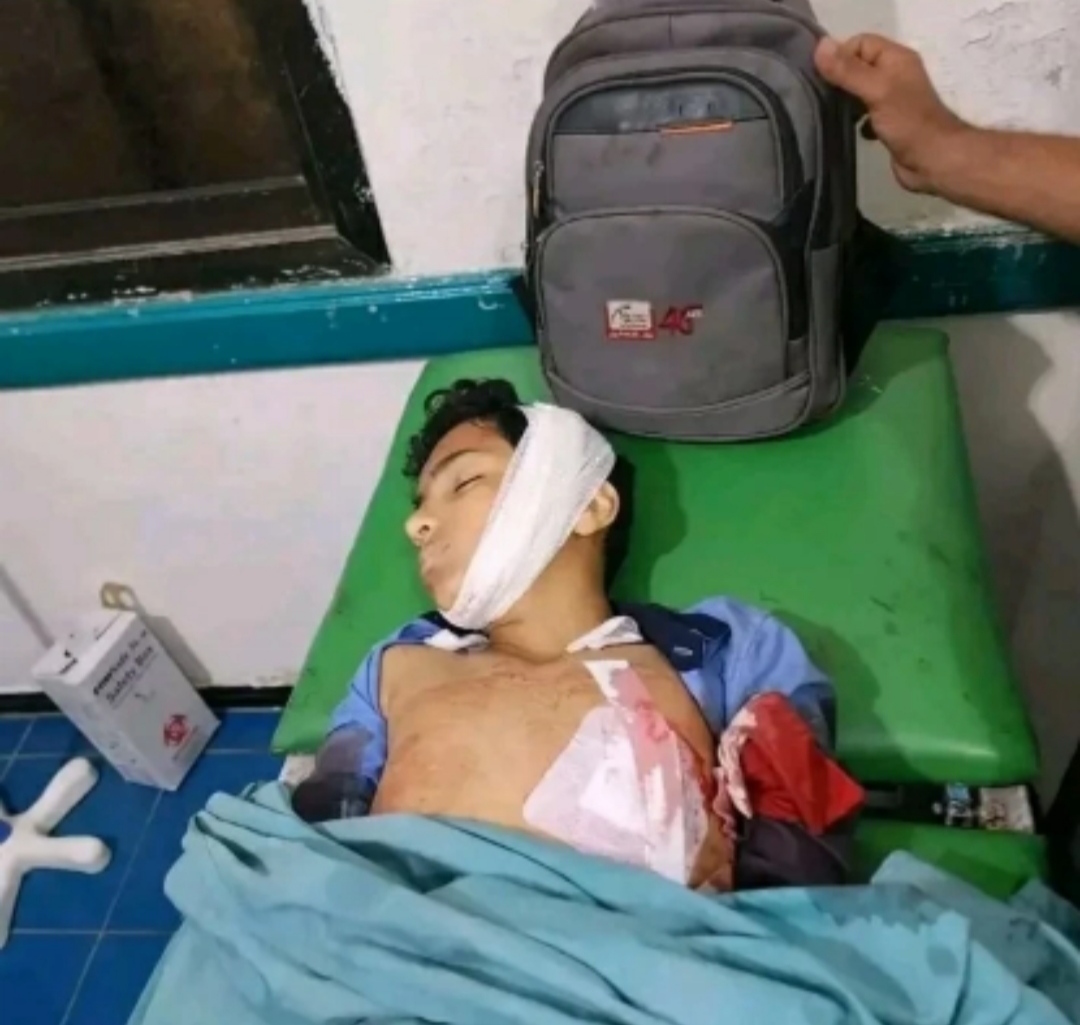 تنديد رسمي بالجرائم الحوثية المستمرة بحق المدنيين في تعز