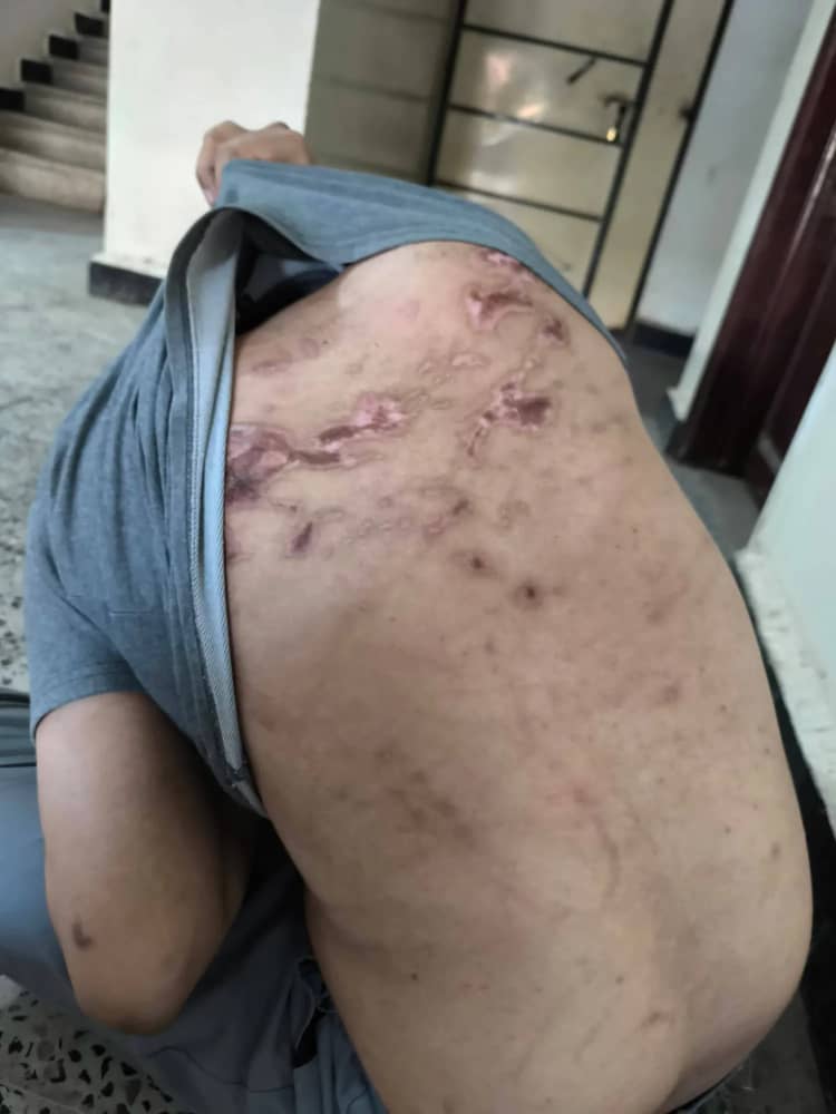 صحيفة سعودية تكشف انتهاكات القوات الإماراتية ضد مختطفين سابقين في حضرموت